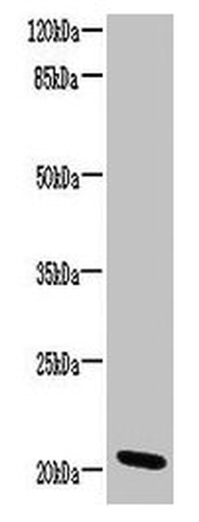 C15orf57 Antibody in Western Blot (WB)