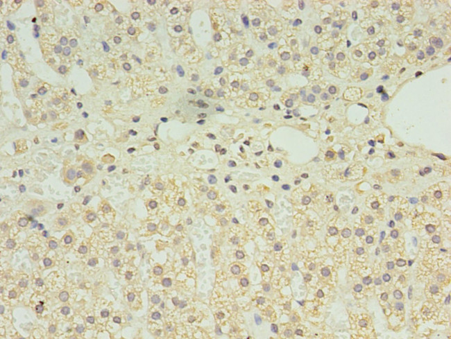 CLPB Antibody in Immunohistochemistry (Paraffin) (IHC (P))