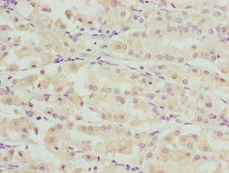 RIBC2 Antibody in Immunohistochemistry (Paraffin) (IHC (P))