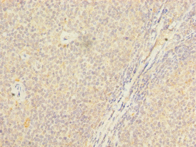 PSTPIP2 Antibody in Immunohistochemistry (Paraffin) (IHC (P))