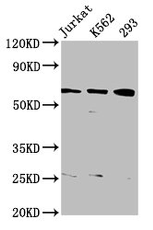 ELP3 Antibody in Western Blot (WB)