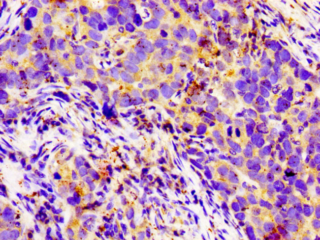 LGR6 Antibody in Immunohistochemistry (Paraffin) (IHC (P))