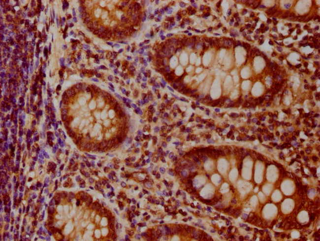 C3orf1 Antibody in Immunohistochemistry (Paraffin) (IHC (P))