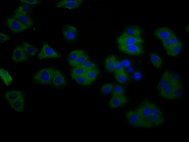 TMEM16B Antibody in Immunocytochemistry (ICC/IF)