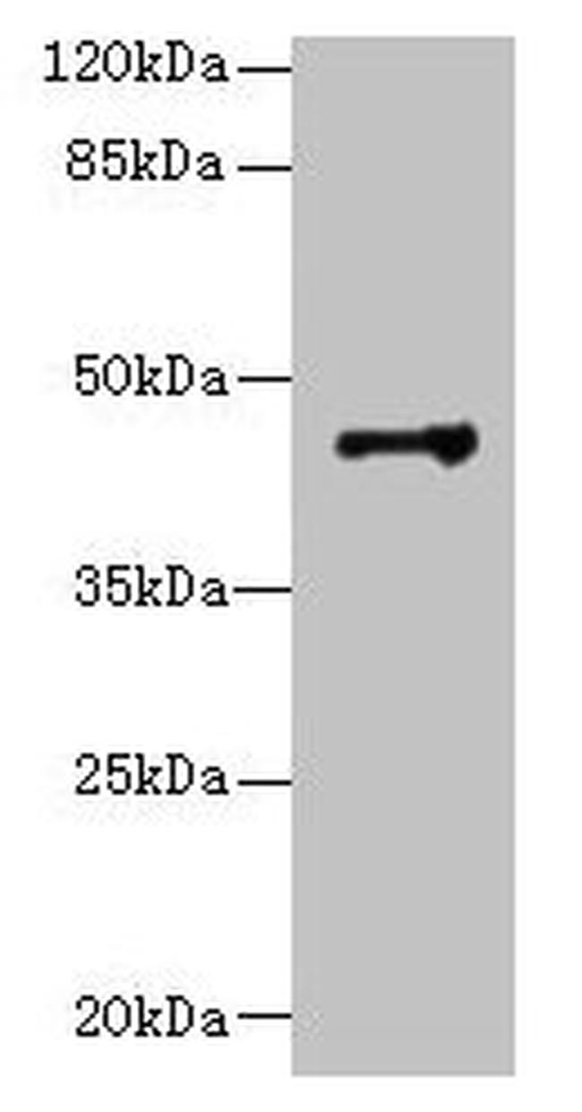 DSCC1 Antibody in Western Blot (WB)