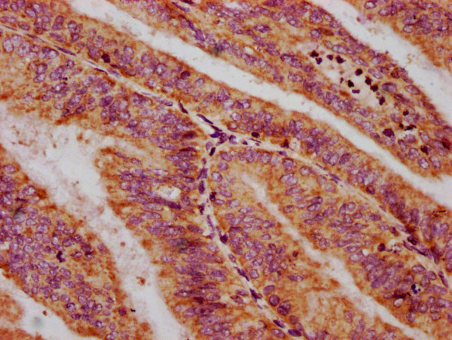 CXorf36 Antibody in Immunohistochemistry (Paraffin) (IHC (P))