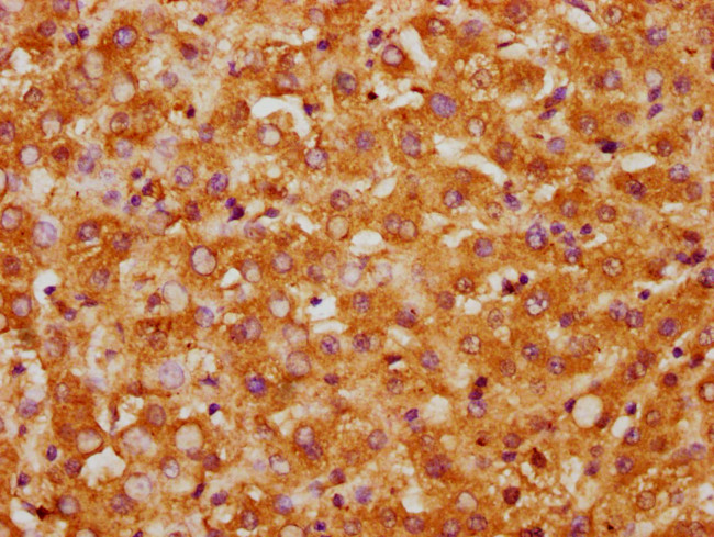 CK1 gamma-1 Antibody in Immunohistochemistry (Paraffin) (IHC (P))