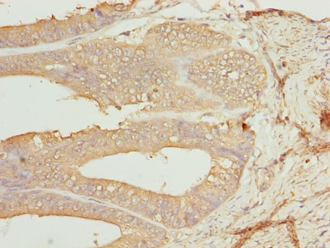 CK1 gamma-1 Antibody in Immunohistochemistry (Paraffin) (IHC (P))
