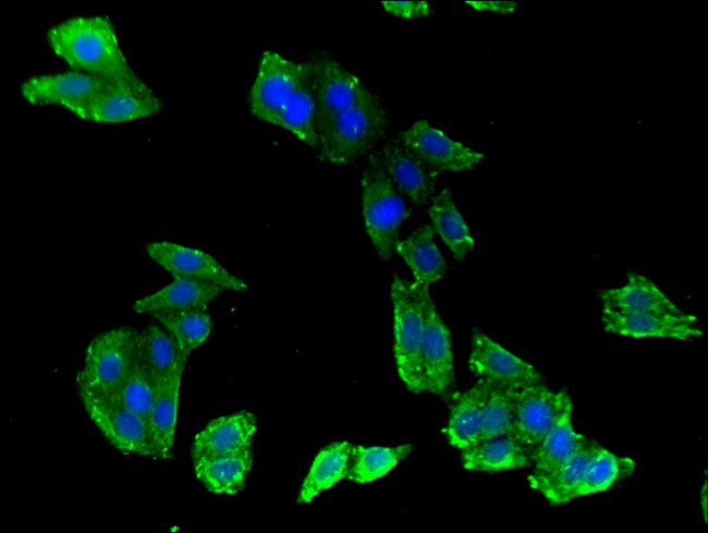 ABCB9 Antibody in Immunocytochemistry (ICC/IF)