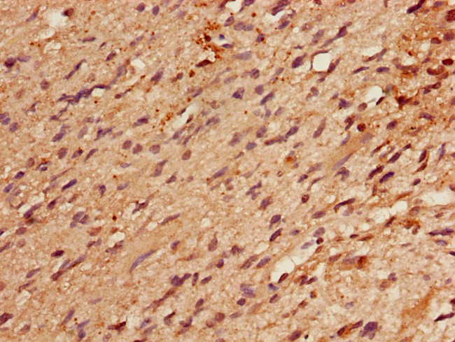RBM22 Antibody in Immunohistochemistry (Paraffin) (IHC (P))