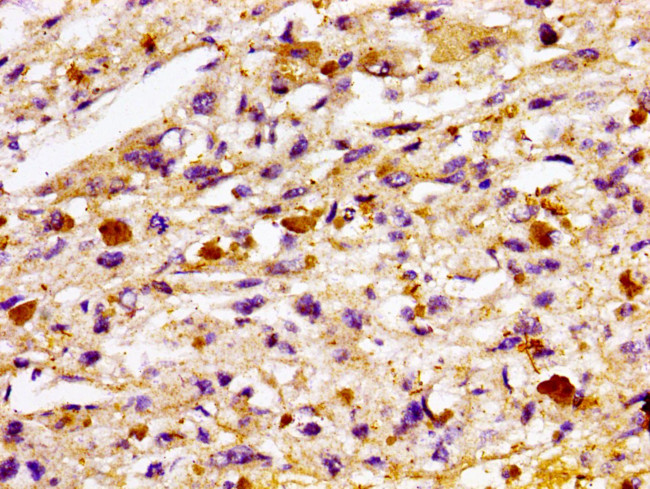 TBC1D14 Antibody in Immunohistochemistry (Paraffin) (IHC (P))