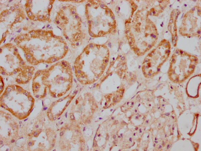 MGAT4B Antibody in Immunohistochemistry (Paraffin) (IHC (P))