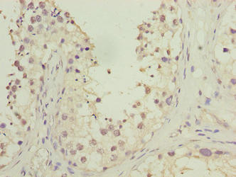HOOK1 Antibody in Immunohistochemistry (Paraffin) (IHC (P))