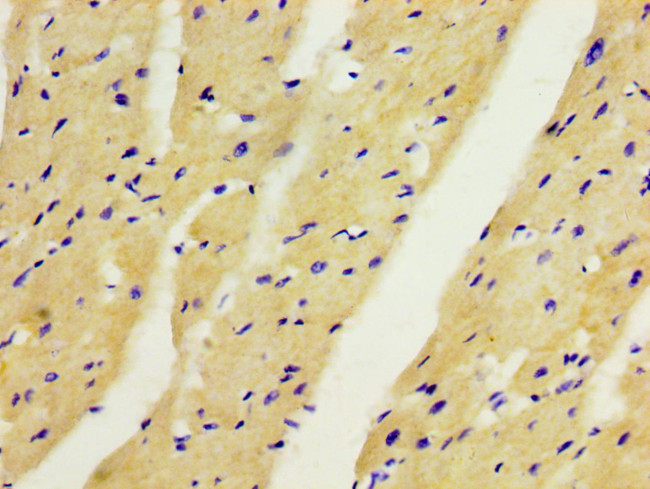 ANGPTL2 Antibody in Immunohistochemistry (Paraffin) (IHC (P))