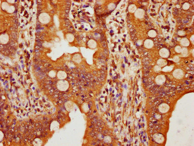 FBXW11 Antibody in Immunohistochemistry (Paraffin) (IHC (P))