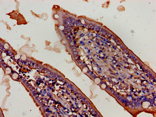 FBXW2 Antibody in Immunohistochemistry (Paraffin) (IHC (P))