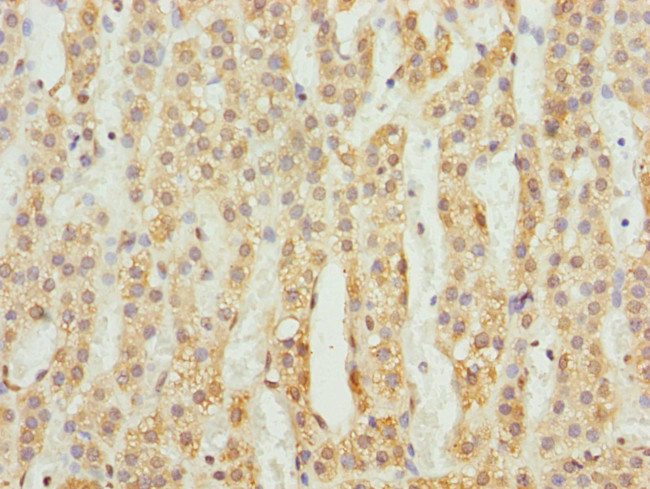 ACSL6 Antibody in Immunohistochemistry (Paraffin) (IHC (P))