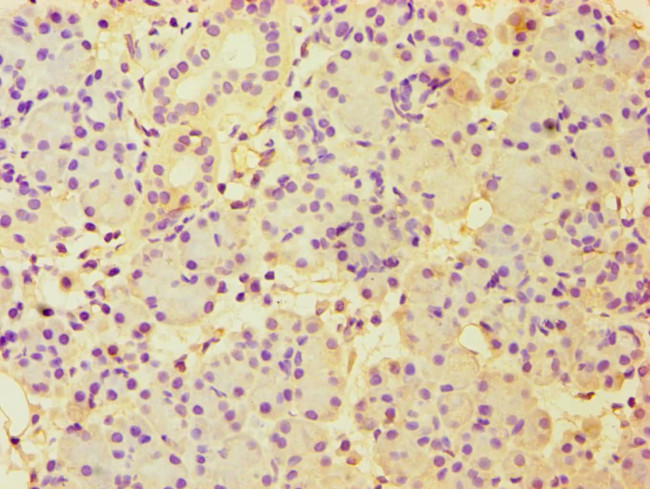 CBLC Antibody in Immunohistochemistry (Paraffin) (IHC (P))