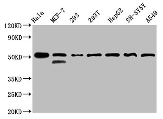 PLAGL1 Antibody in Western Blot (WB)