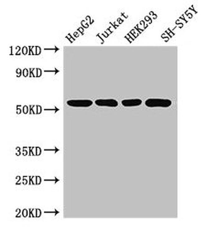 Dynactin 4 Antibody in Western Blot (WB)