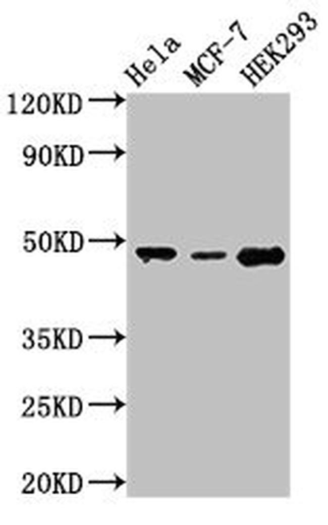 PACSIN3 Antibody in Western Blot (WB)