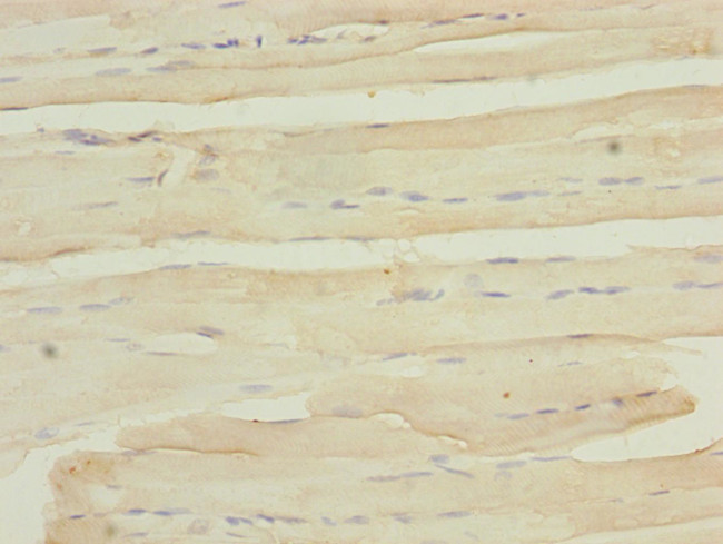 MYO5B Antibody in Immunohistochemistry (Paraffin) (IHC (P))