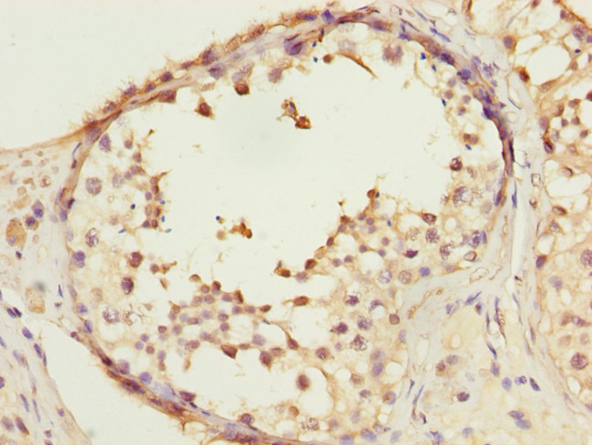 COPS3 Antibody in Immunohistochemistry (Paraffin) (IHC (P))