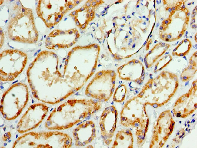 AP1M2 Antibody in Immunohistochemistry (Paraffin) (IHC (P))