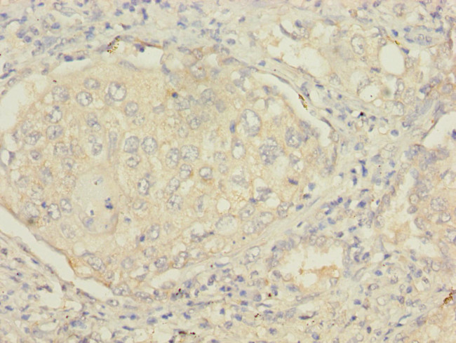 MSRB2 Antibody in Immunohistochemistry (Paraffin) (IHC (P))