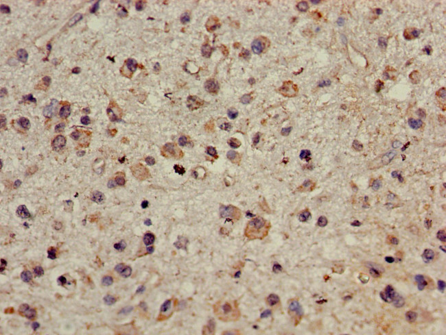 CDYL Antibody in Immunohistochemistry (Paraffin) (IHC (P))