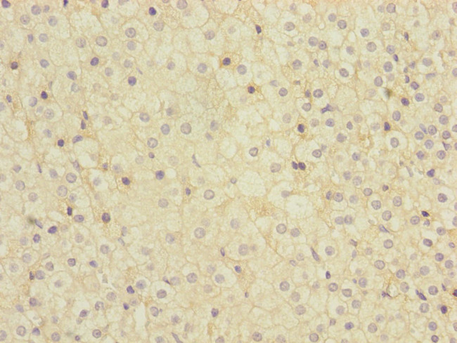 MMACHC Antibody in Immunohistochemistry (Paraffin) (IHC (P))