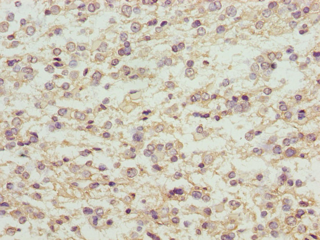 MAGED1 Antibody in Immunohistochemistry (Paraffin) (IHC (P))
