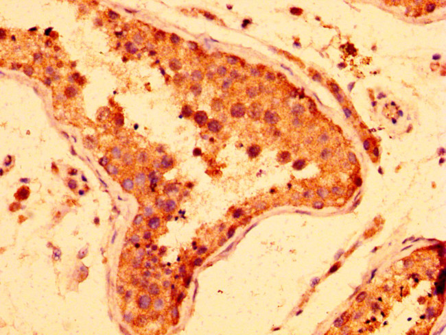 LRRFIP2 Antibody in Immunohistochemistry (Paraffin) (IHC (P))