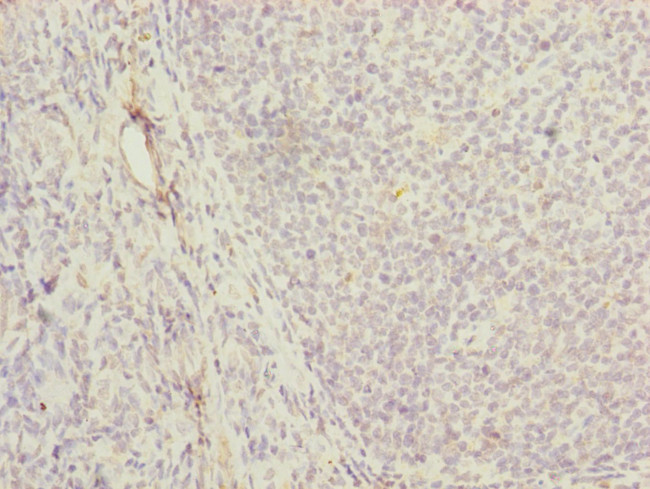 MRPS16 Antibody in Immunohistochemistry (Paraffin) (IHC (P))