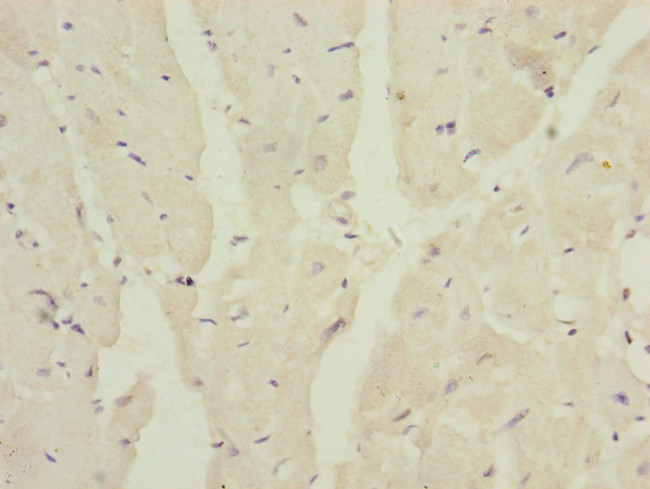 MRPS16 Antibody in Immunohistochemistry (Paraffin) (IHC (P))
