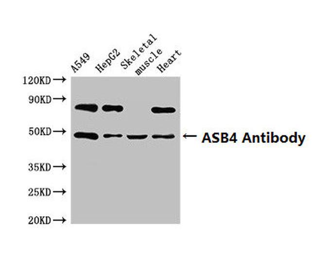 ASB4 Antibody in Western Blot (WB)