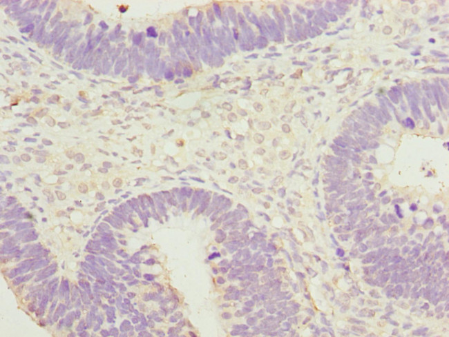 SPIN1 Antibody in Immunohistochemistry (Paraffin) (IHC (P))