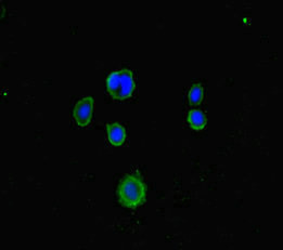 LRCH1 Antibody in Immunocytochemistry (ICC/IF)