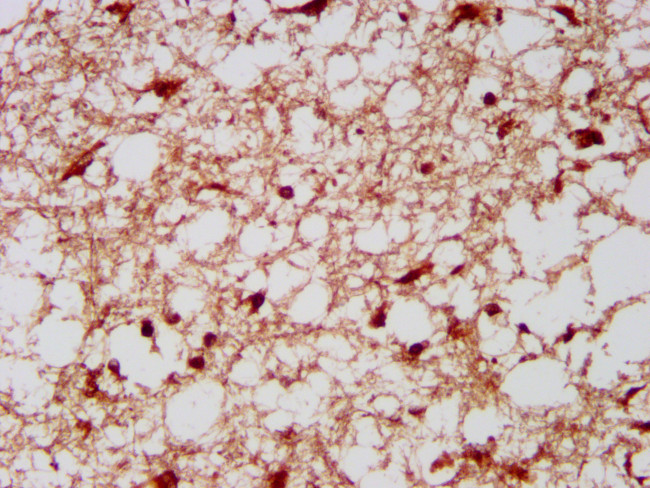 RFLAT-1 Antibody in Immunohistochemistry (Paraffin) (IHC (P))