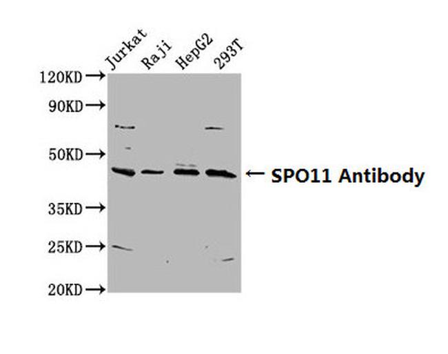 SPO11 Antibody in Western Blot (WB)