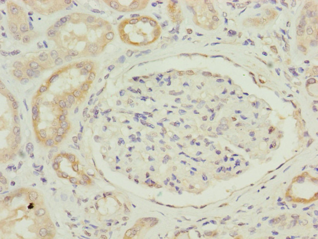 FAM96B Antibody in Immunohistochemistry (Paraffin) (IHC (P))