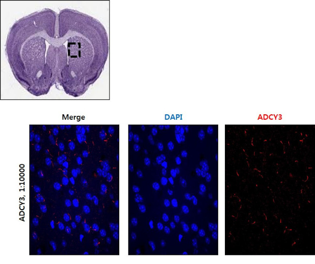 ADCY3 Antibody in Immunohistochemistry (IHC)