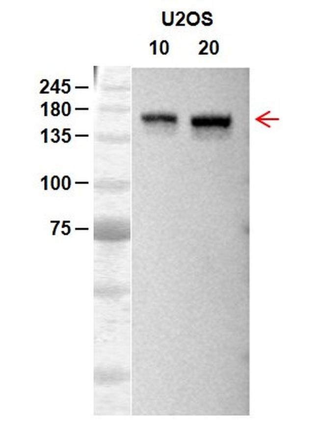 RecQL4 Antibody in Western Blot (WB)