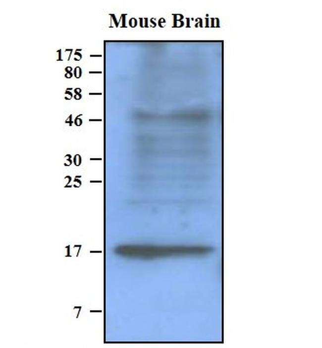 pan Synuclein Antibody in Western Blot (WB)