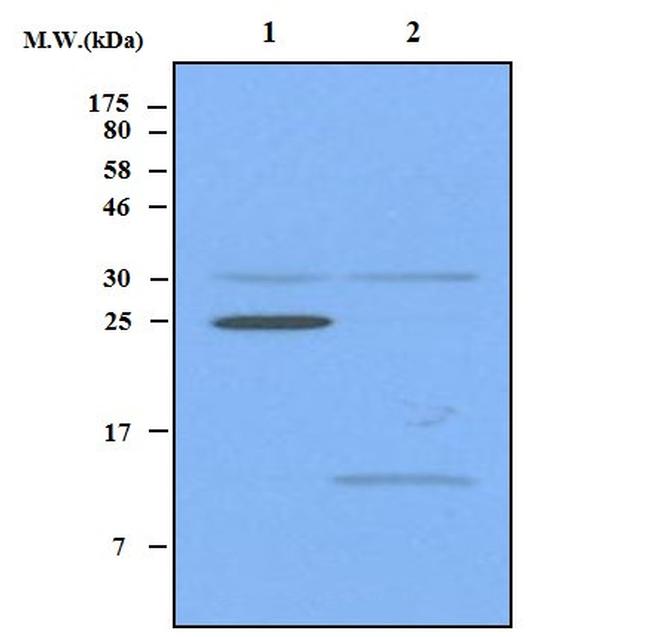 RPLA/Ribosomal Protein L1 Antibody in Western Blot (WB)