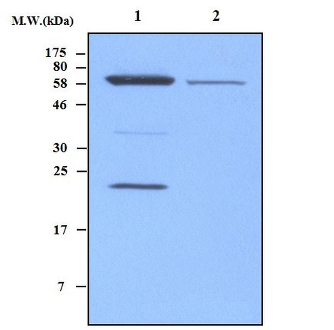 MnSOD Antibody in Western Blot (WB)