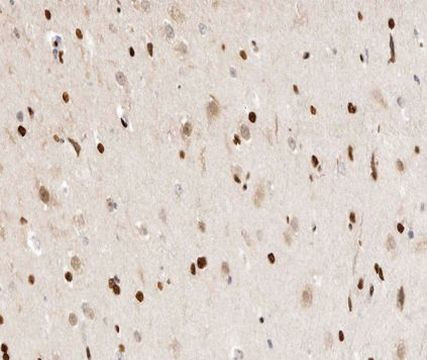 Phospho-hnRNP D (Ser83) Antibody in Immunohistochemistry (Paraffin) (IHC (P))