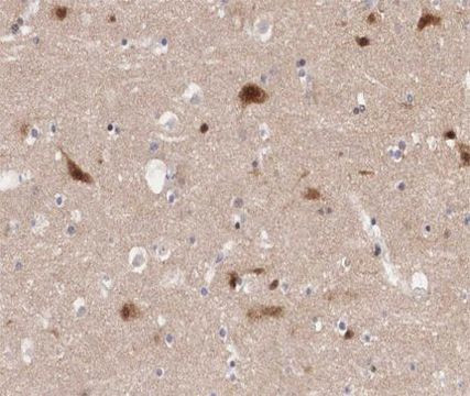 Phospho-PAK3 (Ser154) Antibody in Immunohistochemistry (Paraffin) (IHC (P))