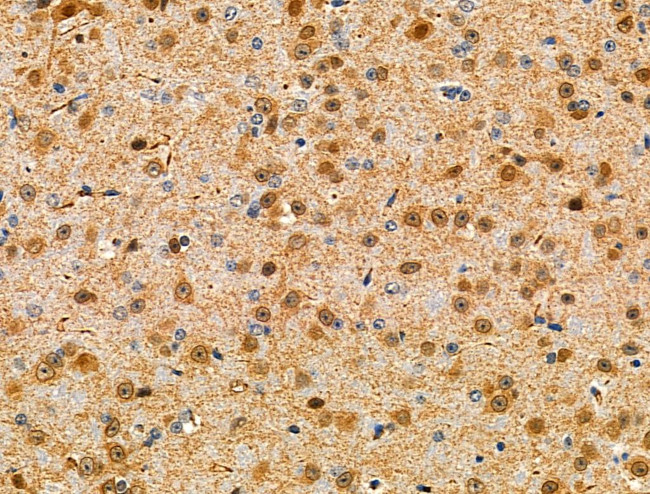 Phospho-C-RAF (Ser301) Antibody in Immunohistochemistry (Paraffin) (IHC (P))