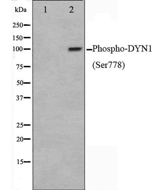 Phospho-Dynamin 1 (Ser778) Antibody in Western Blot (WB)